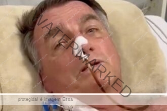 Médico afirma que cirurgia de Bolsonaro foi “complexa e delicada”